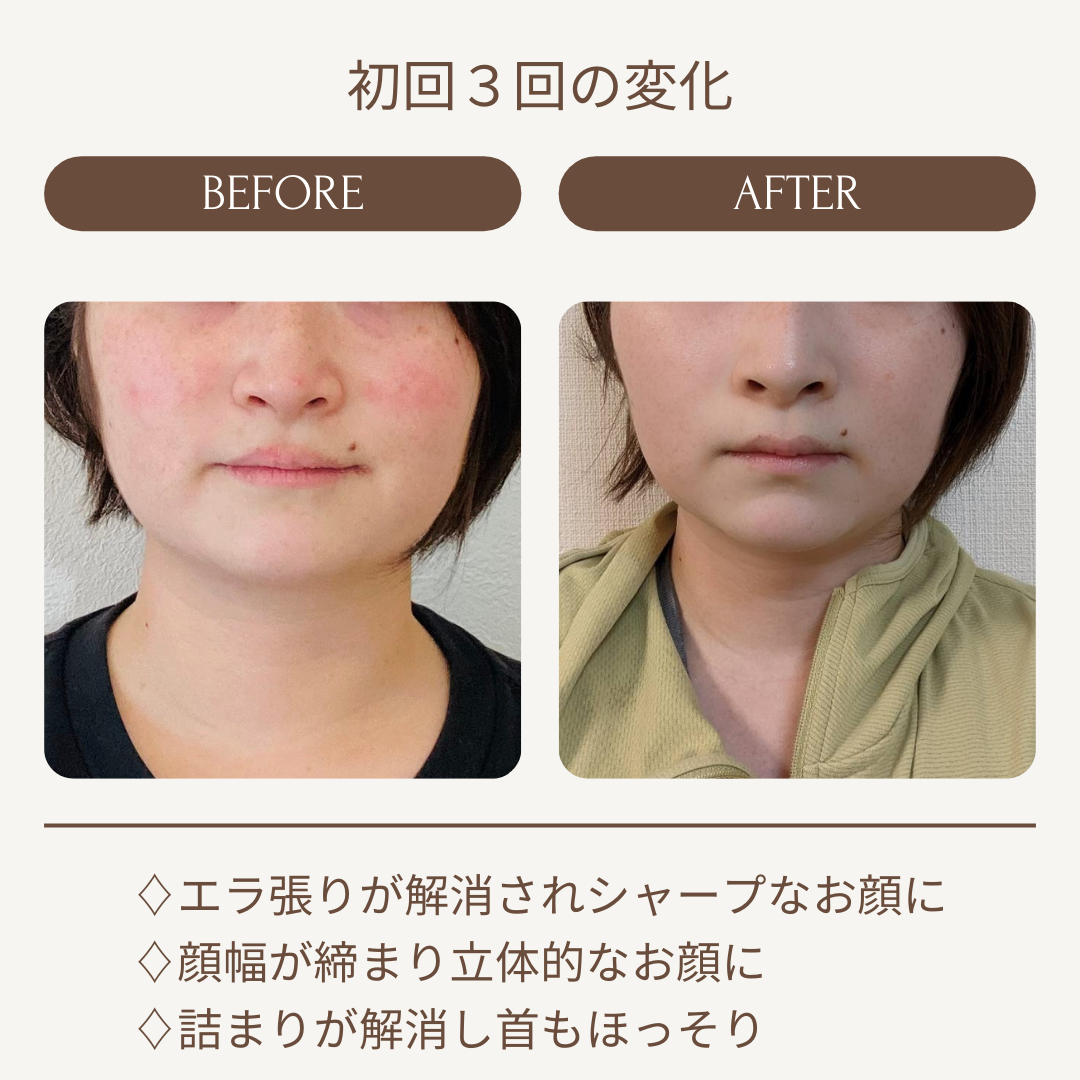 Kafuuのビフォーアフター