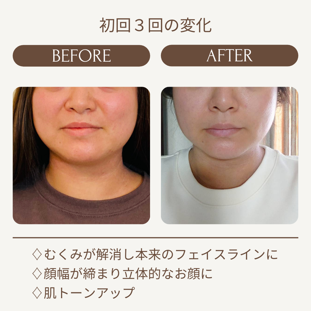 Kafuuのビフォーアフター