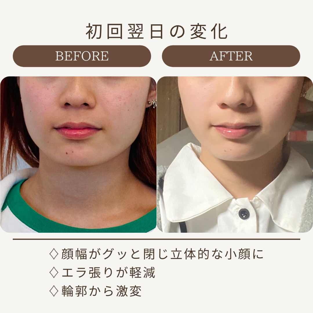 Kafuuのビフォーアフター