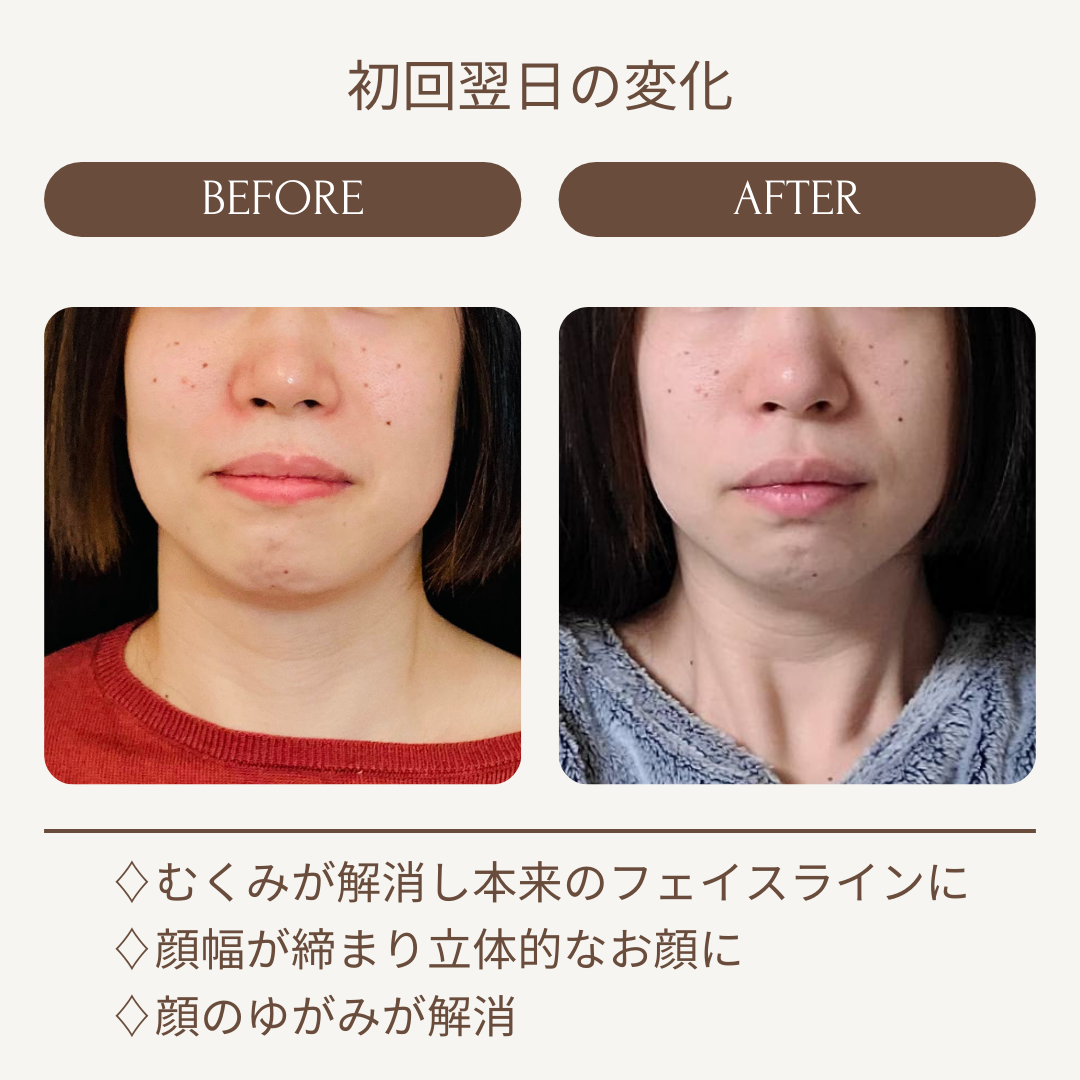 Kafuuのビフォーアフター