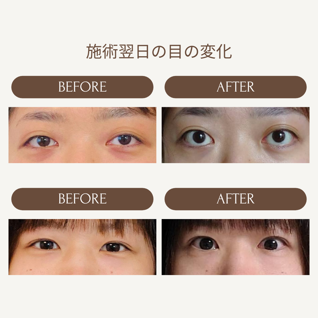 Kafuuのビフォーアフター