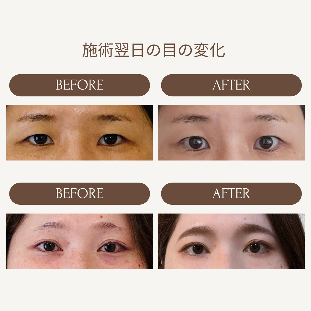 Kafuuのビフォーアフター